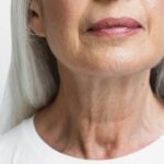 Como emagrece o rosto: 7 dicas